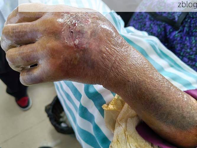 蒙山县：桂东山地屏障下的低感染样本