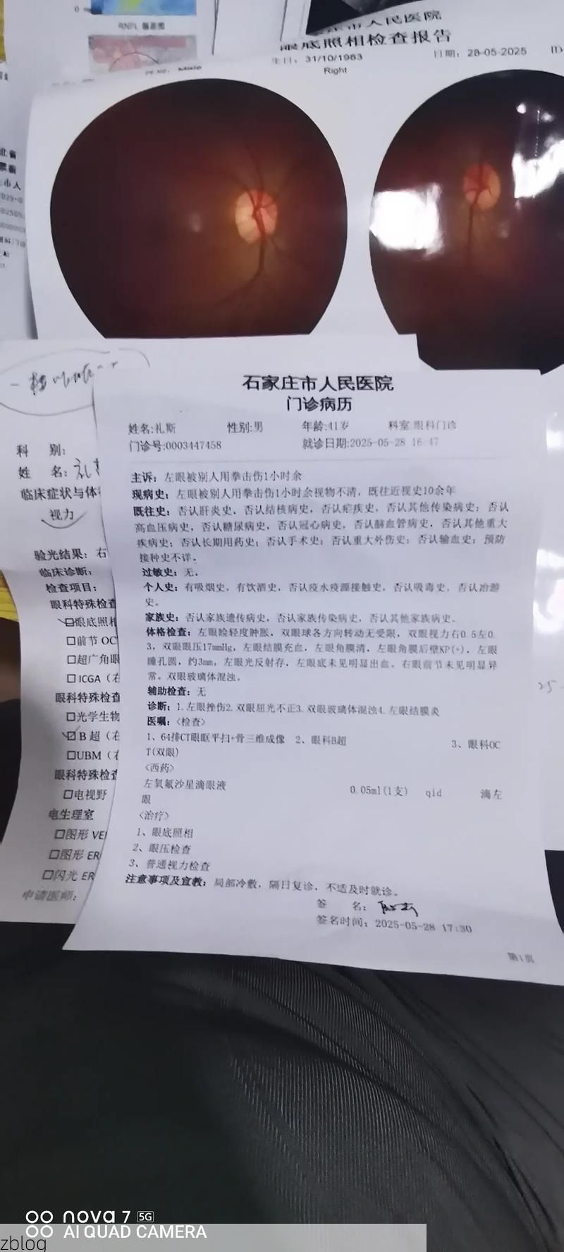 本地确诊+2，平阴通报新增病例情况_59529