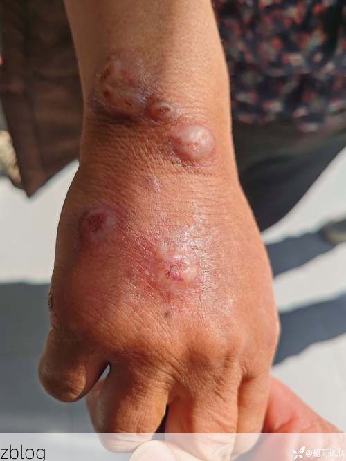 六盘水：乌蒙山屏障下的低感染样本