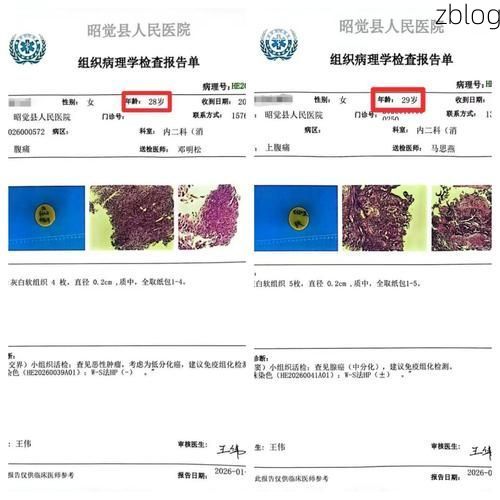 2022年9月2日凉山新增确诊病例情况