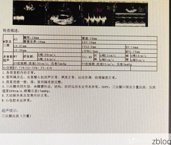 2022年3月15日月湖区新增确诊病例情况_20066