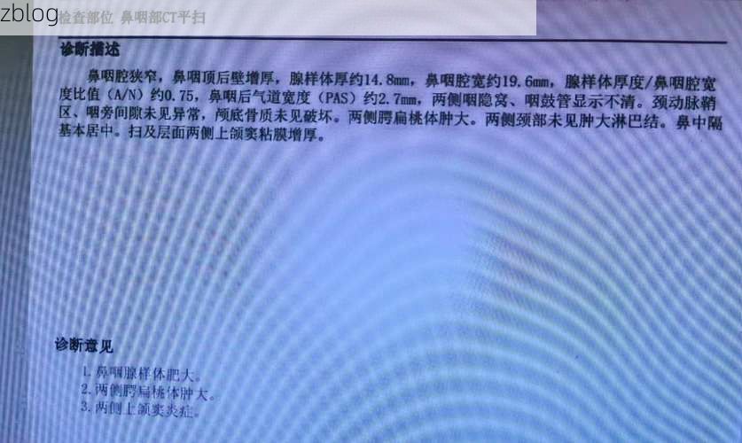 【本地确诊+3，蔡甸区通报新增病例情况_22227】