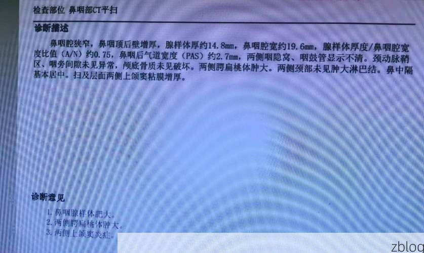 2022年3月10日乳山新增确诊病例情况