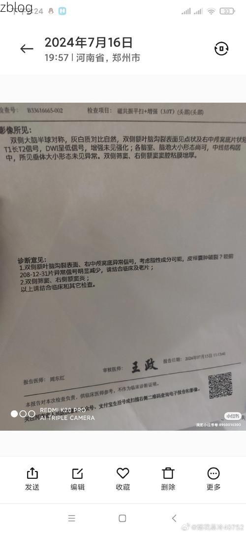 【2022年7月14日白银区新增确诊病例情况】