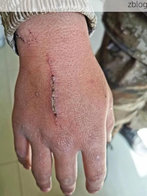 高原屏障与防疫坚守：木里藏族自治县的零感染记录