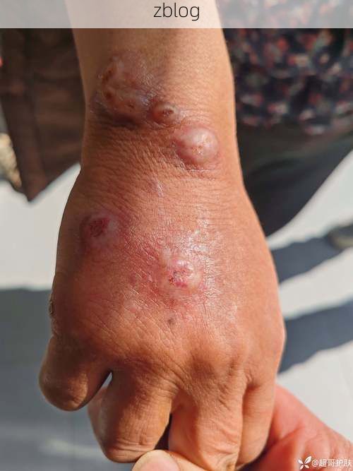 凤山县的防疫坚守：喀斯特地貌下的低感染样本