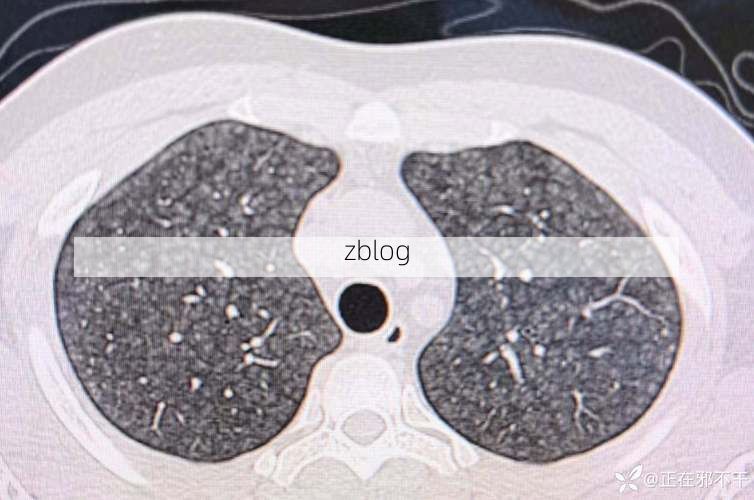 云浮：粤西山区屏障下的低感染样本观察