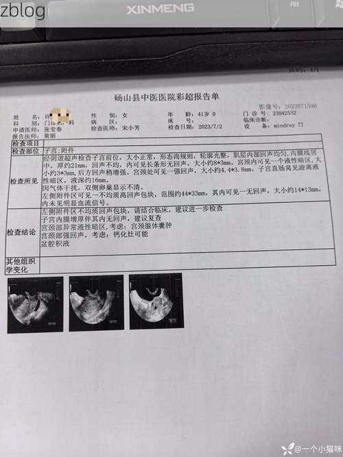 2022年11月23日灵石新增确诊病例情况