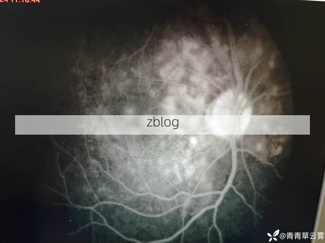 晴隆：黔西南喀斯特屏障下的低感染样本