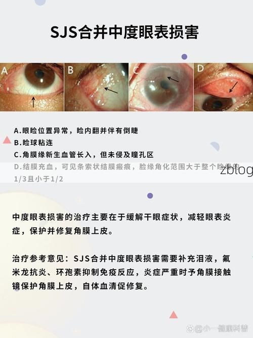 金城江：喀斯特峰丛屏障下的低感染样本解析