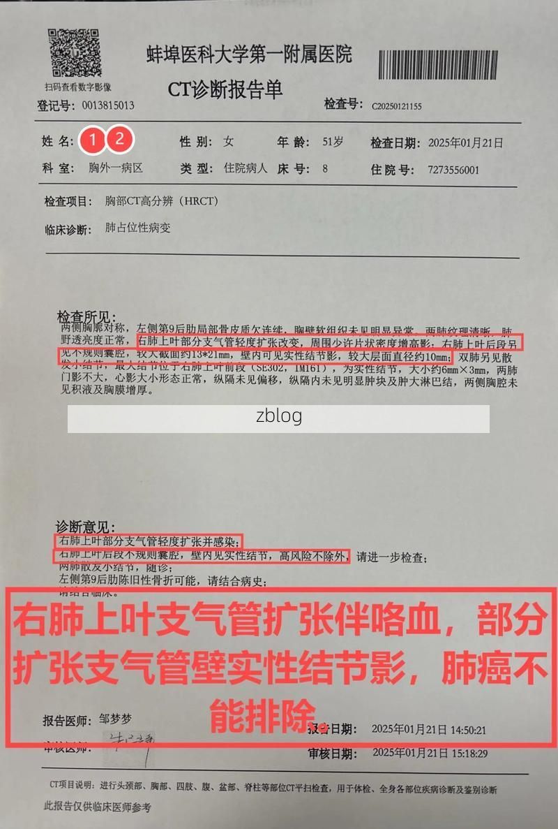 2022年7月15日玉门新增确诊病例情况_54142